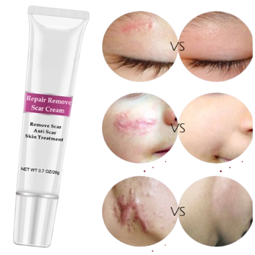 Skin Repair Cream