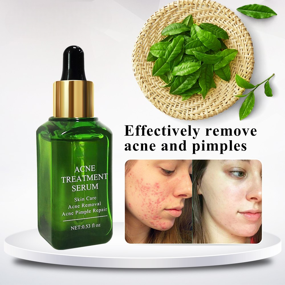 Acne Pimple Remover Serum