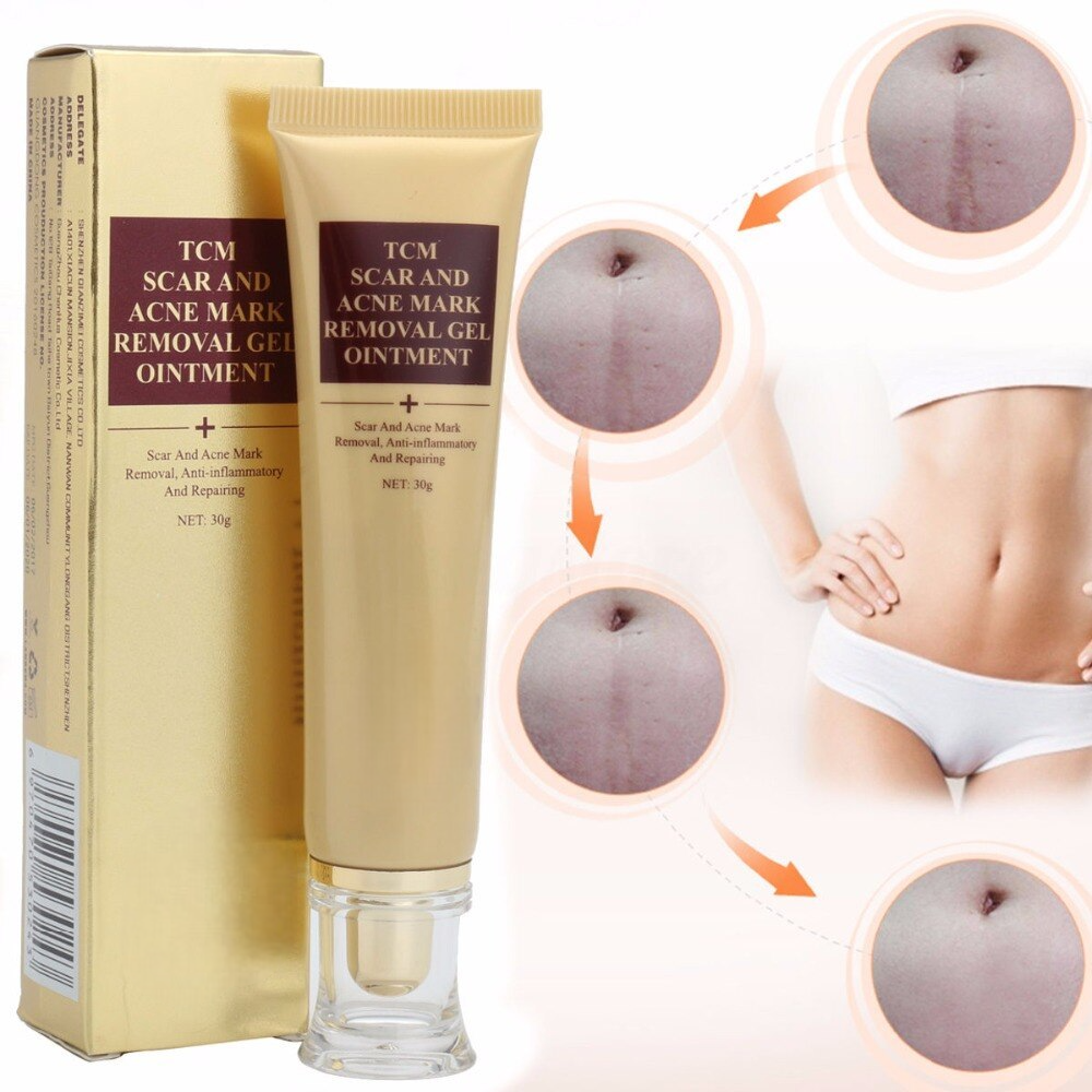Acne Scar Removal Cream