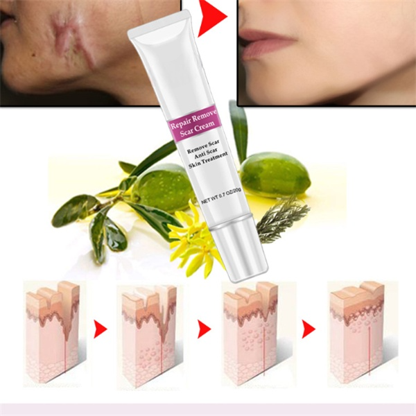 Skin Repair Cream