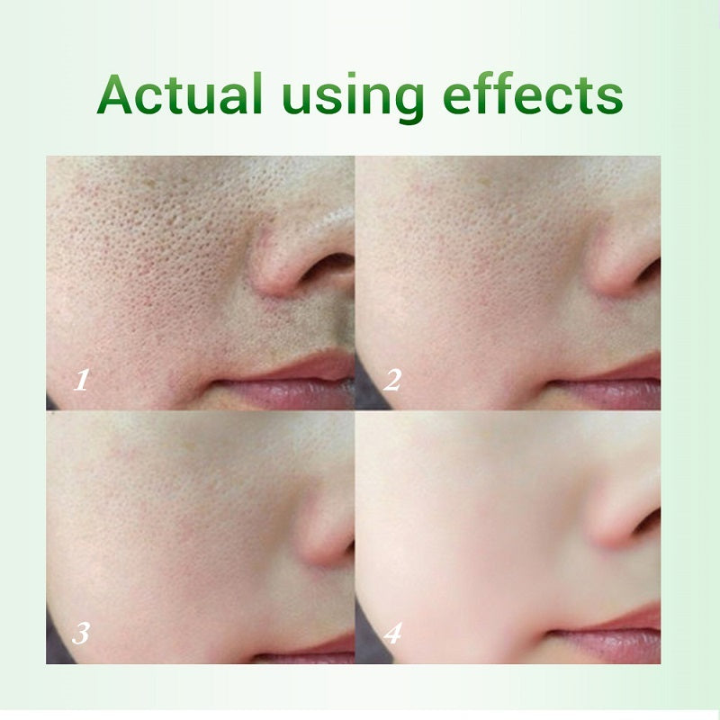 Salicylic Pore Refining Cream