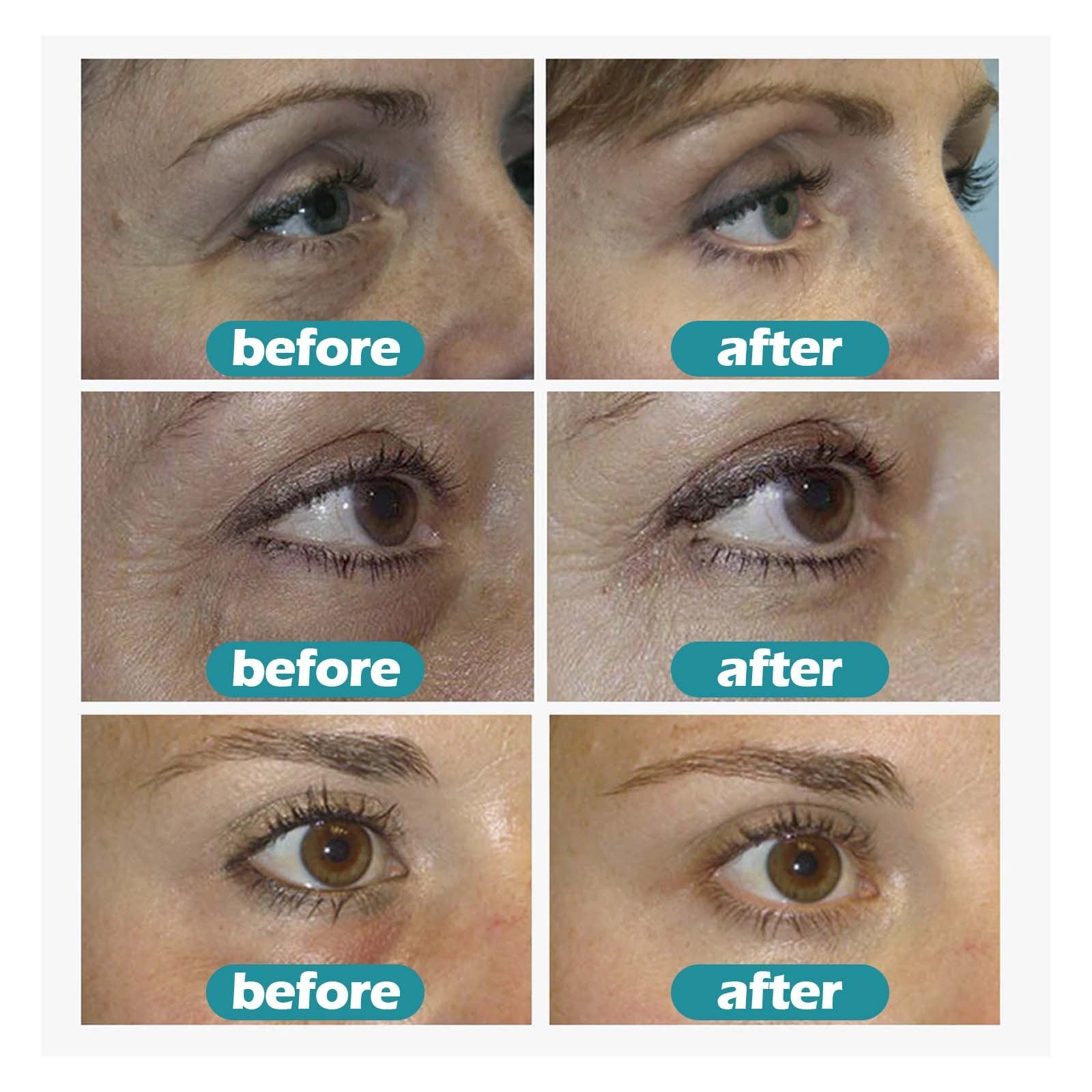 Eye Bag Repair Gel